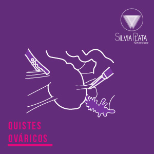 imagen quistes ováricos ginecologia y obstetricia en bogota ginecologa silvia plata - Artículos de ginecología